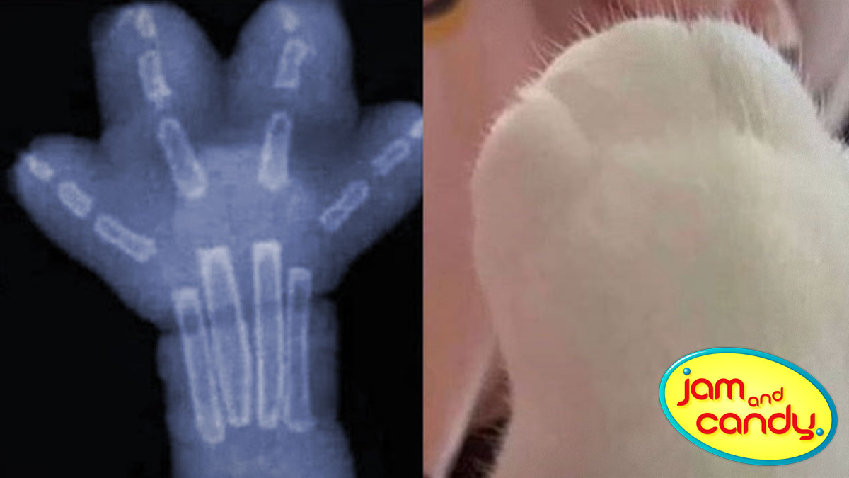 World Radiography Day